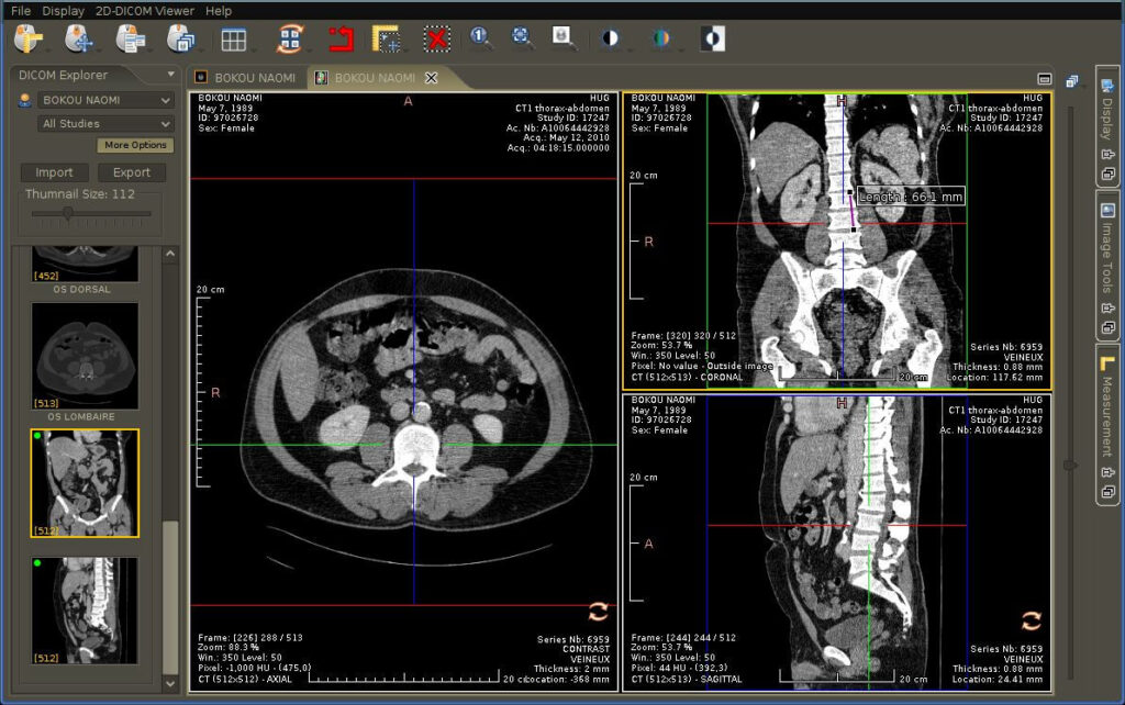 DICOM viewer free online